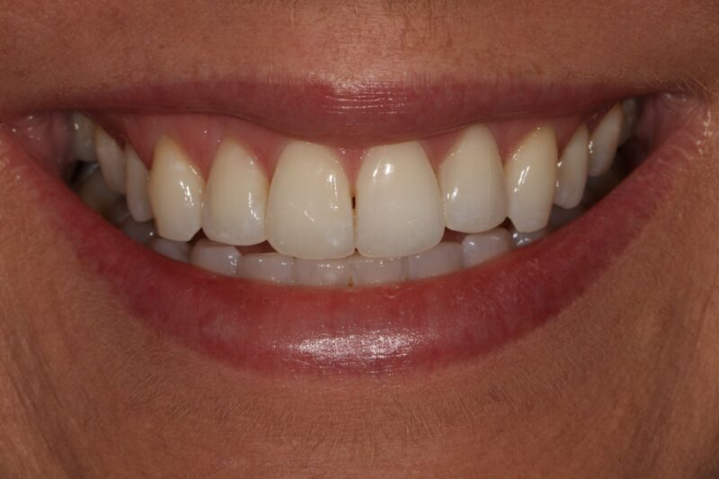 After - Cheadle Hulme Dental