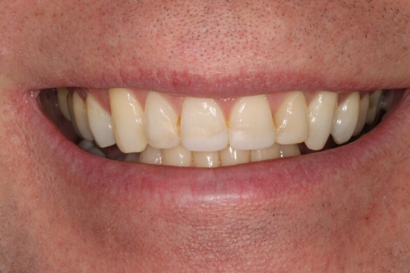 After - Cheadle Hulme Dental