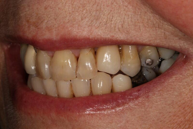 After - Cheadle Hulme Dental