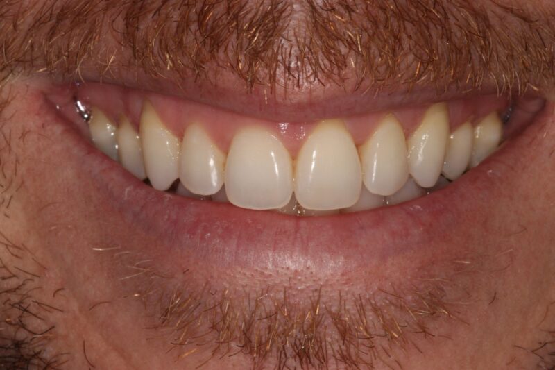 After - Cheadle Hulme Dental