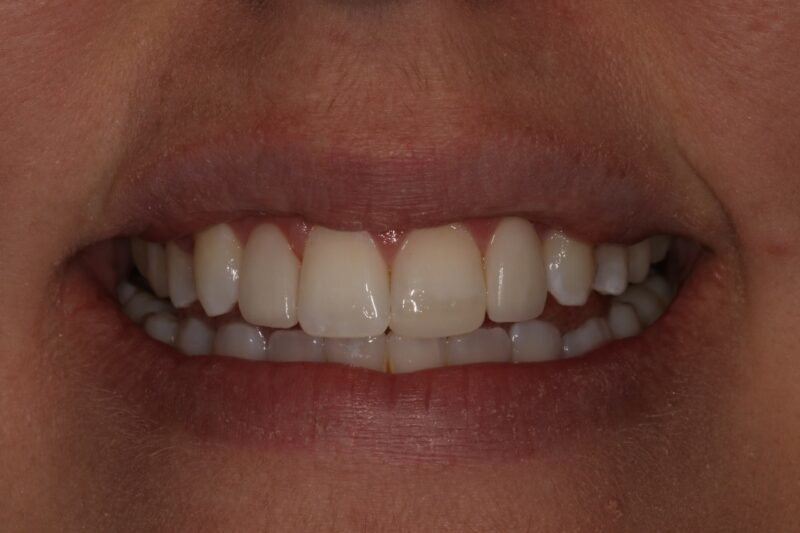 After - Cheadle Hulme Dental