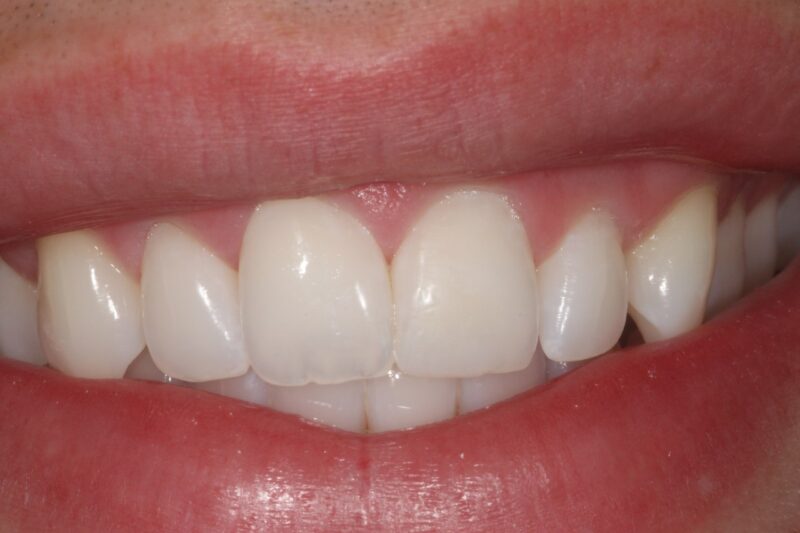 After - Cheadle Hulme Dental