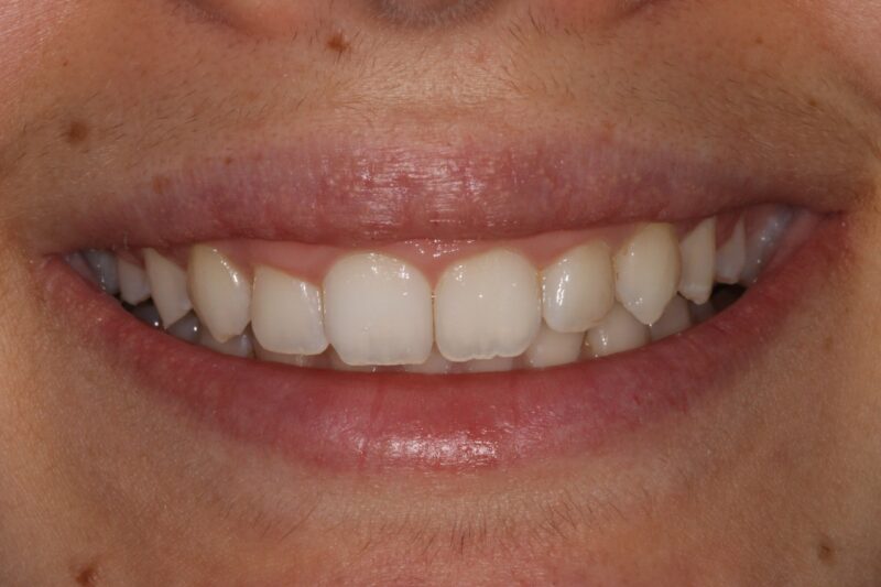 After - Cheadle Hulme Dental