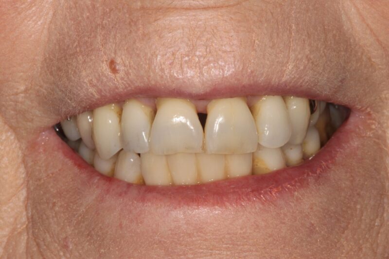 After - Cheadle Hulme Dental