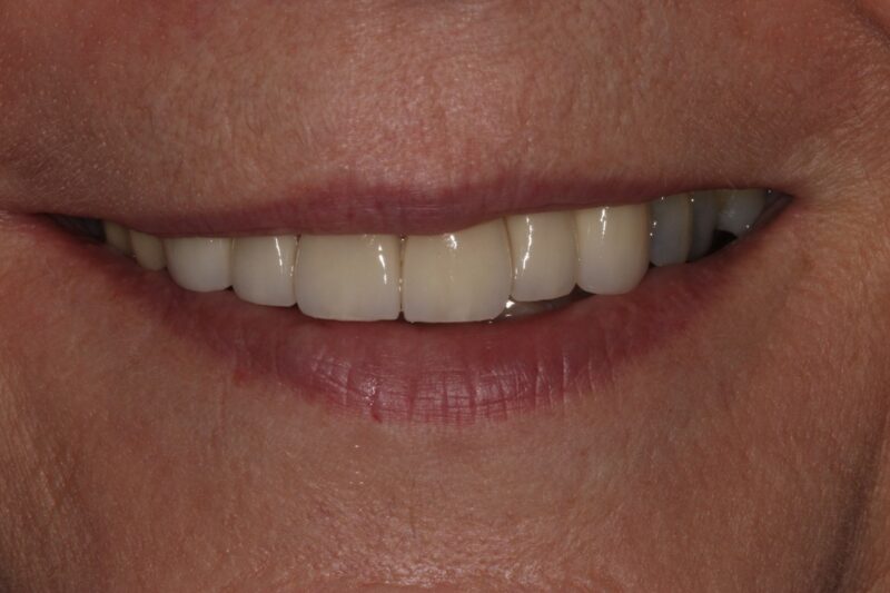 After - Cheadle Hulme Dental