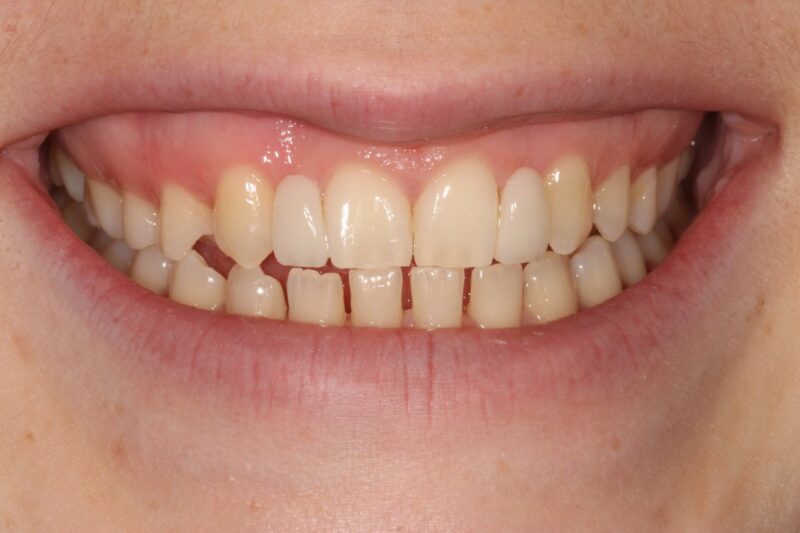 After - Cheadle Hulme Dental