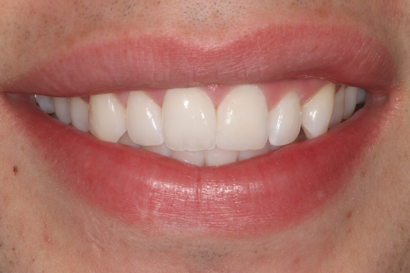 After - Cheadle Hulme Dental