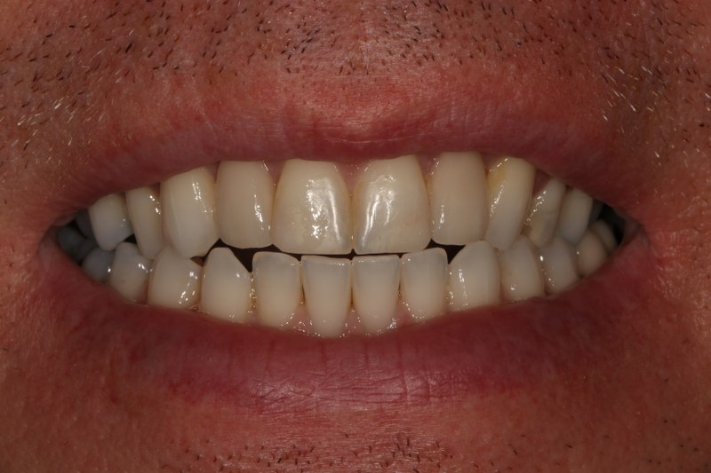 After - Cheadle Hulme Dental