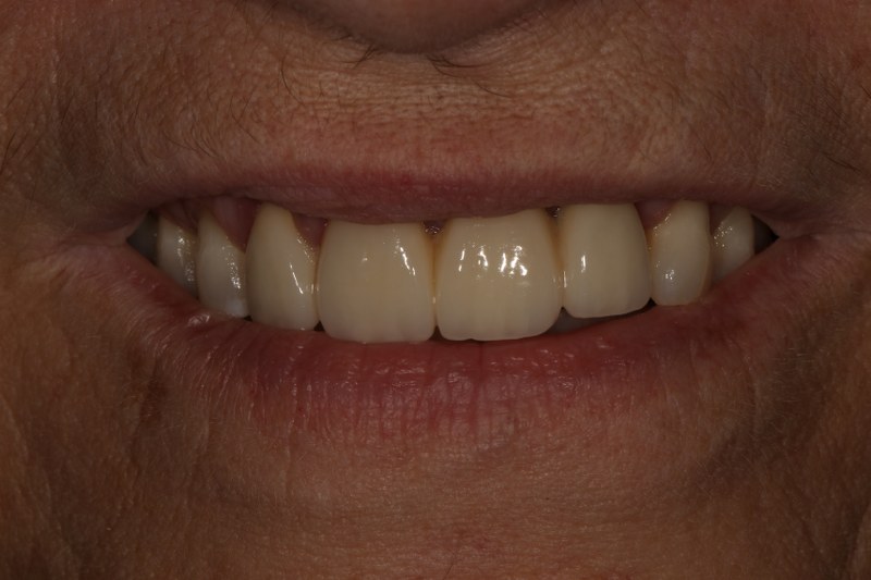 After - Cheadle Hulme Dental