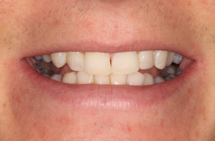 After - Cheadle Hulme Dental