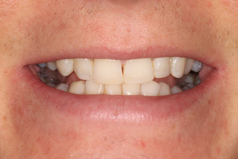 After - Cheadle Hulme Dental