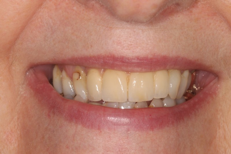 After - Cheadle Hulme Dental