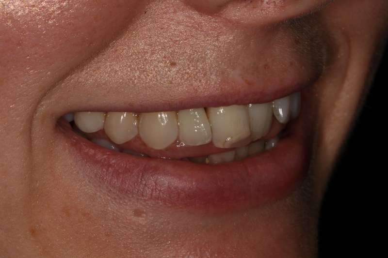 After - Cheadle Hulme Dental