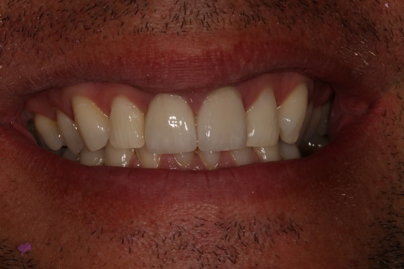 After - Cheadle Hulme Dental