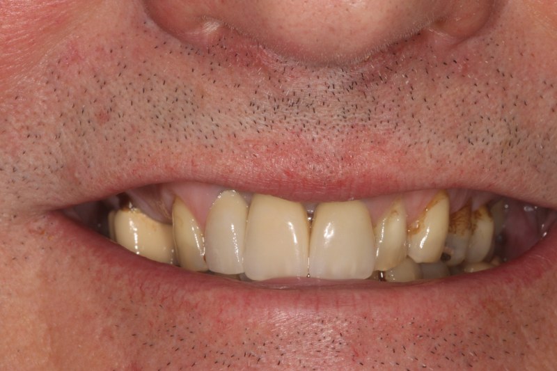 After - Cheadle Hulme Dental