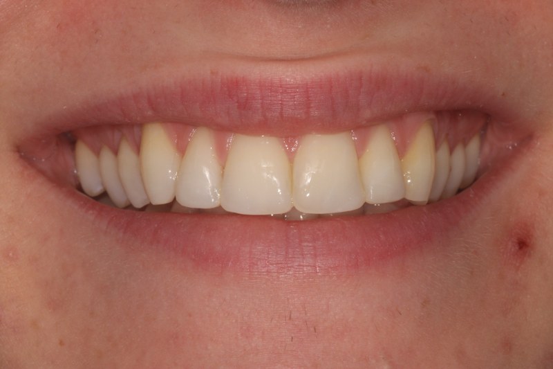 After - Cheadle Hulme Dental