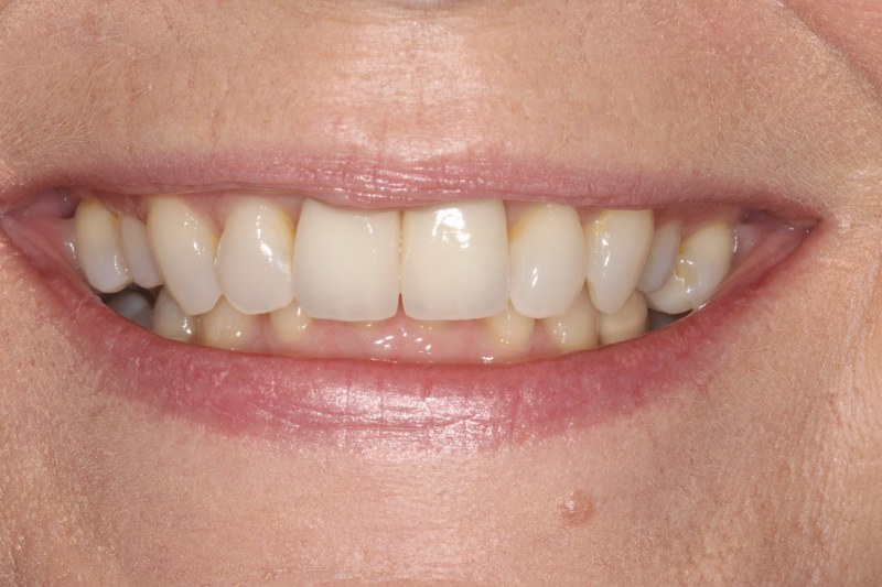 After - Cheadle Hulme Dental