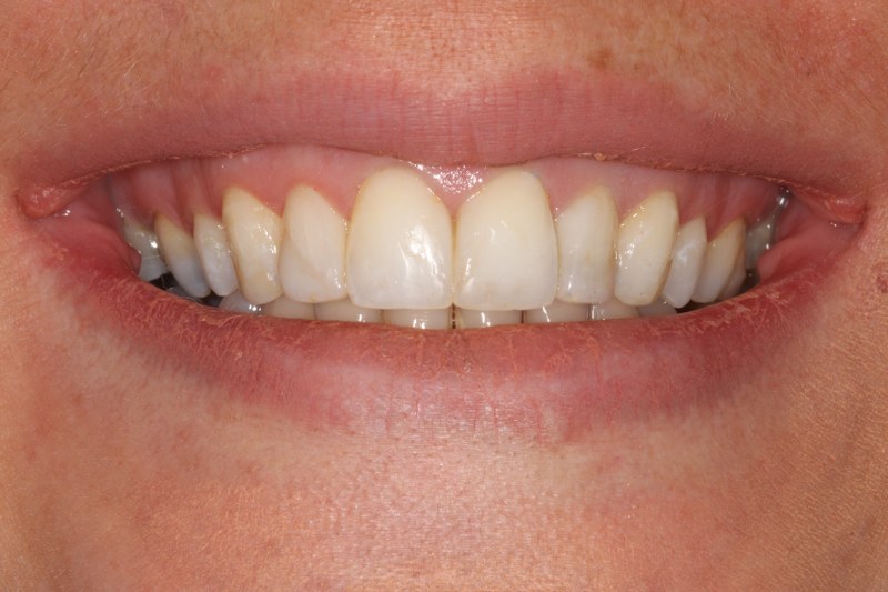 After - Cheadle Hulme Dental