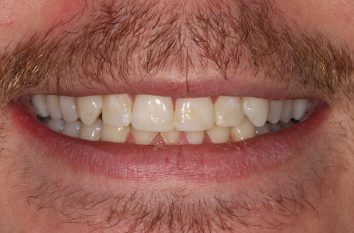 After - Cheadle Hulme Dental