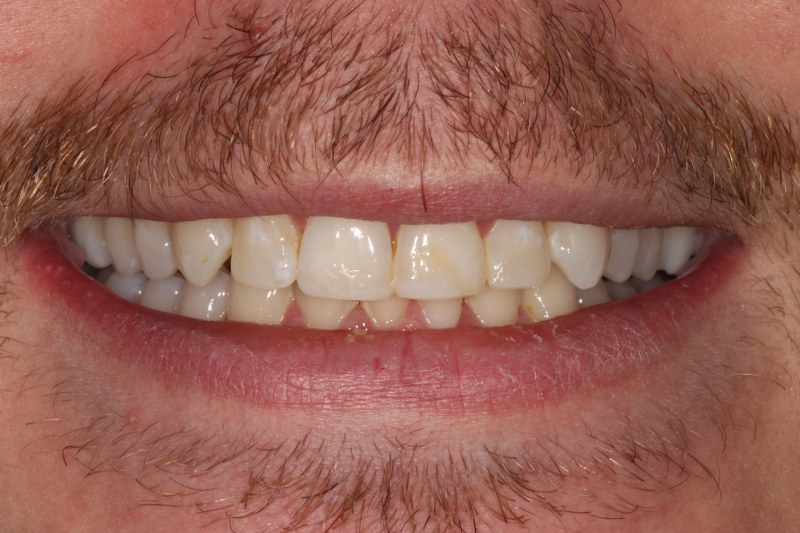 After - Cheadle Hulme Dental