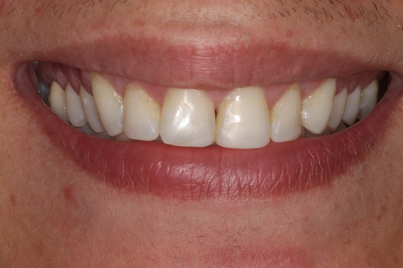 After - Cheadle Hulme Dental