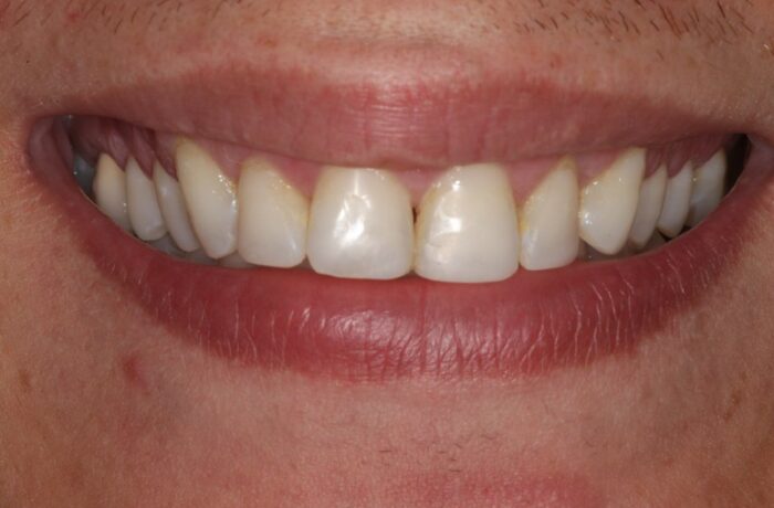 After - Cheadle Hulme Dental