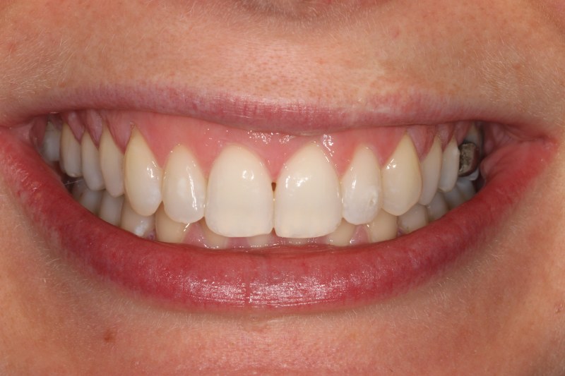 After - Cheadle Hulme Dental