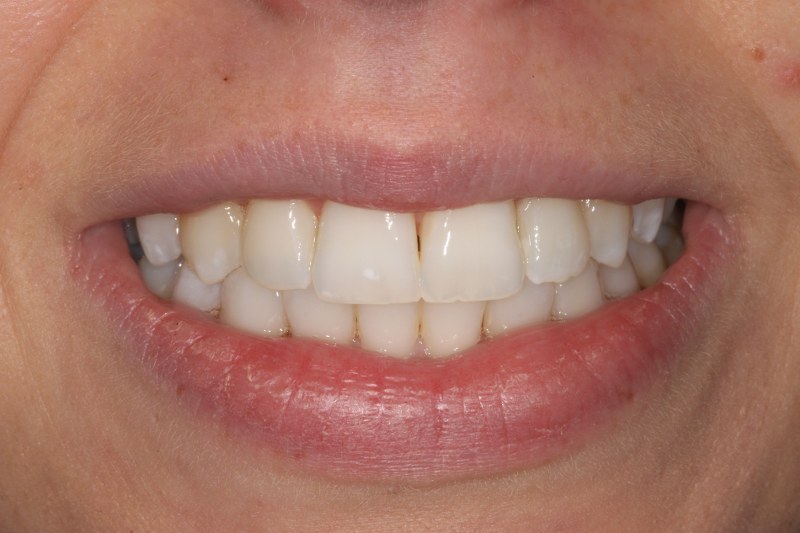 After - Cheadle Hulme Dental