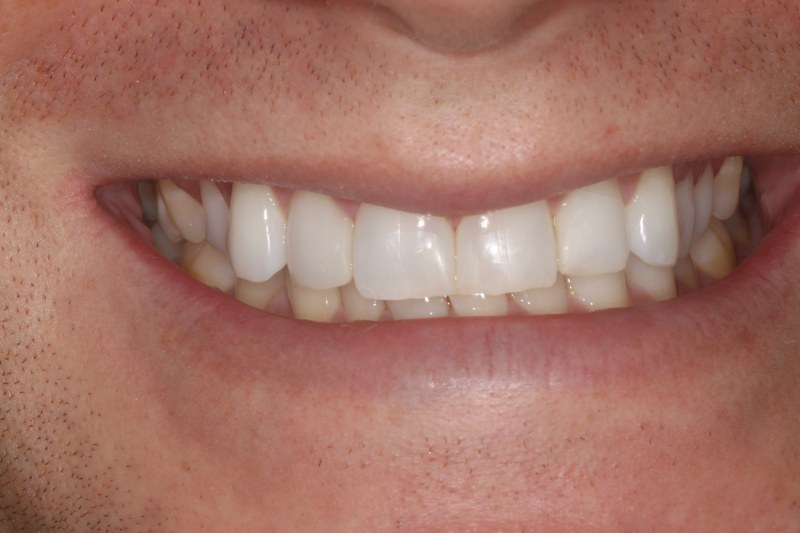 After - Cheadle Hulme Dental