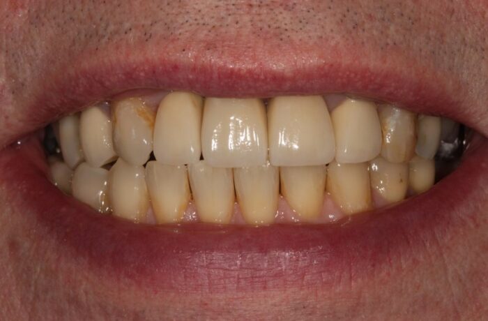 After - Cheadle Hulme Dental