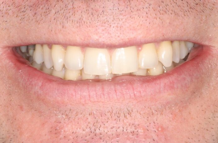 After - Cheadle Hulme Dental