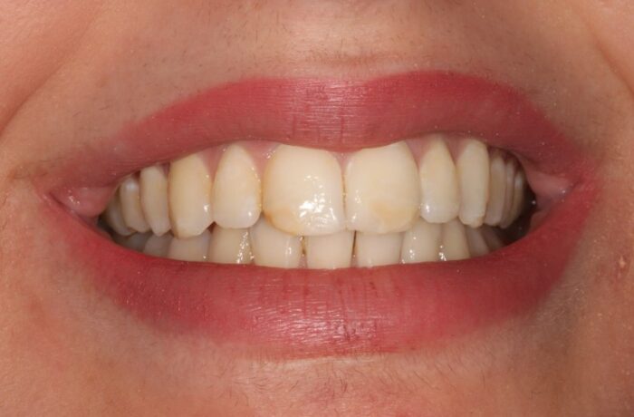 After - Cheadle Hulme Dental