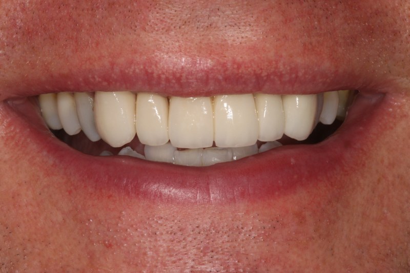 After - Cheadle Hulme Dental