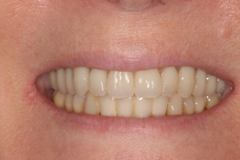 After - Cheadle Hulme Dental