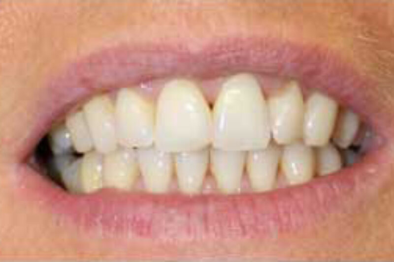 After - Cheadle Hulme Dental