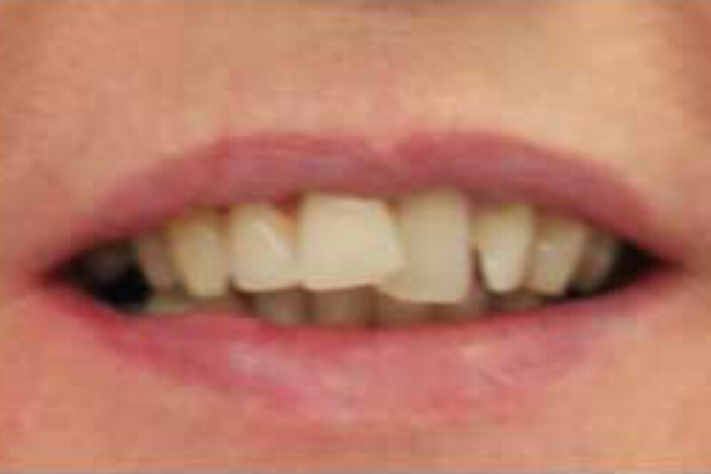 Before - Cheadle Hulme Dental