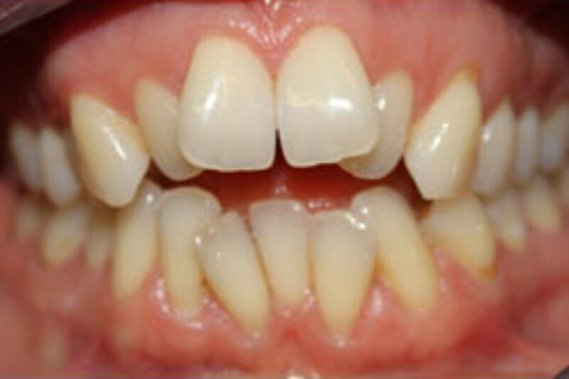 Before - Cheadle Hulme Dental