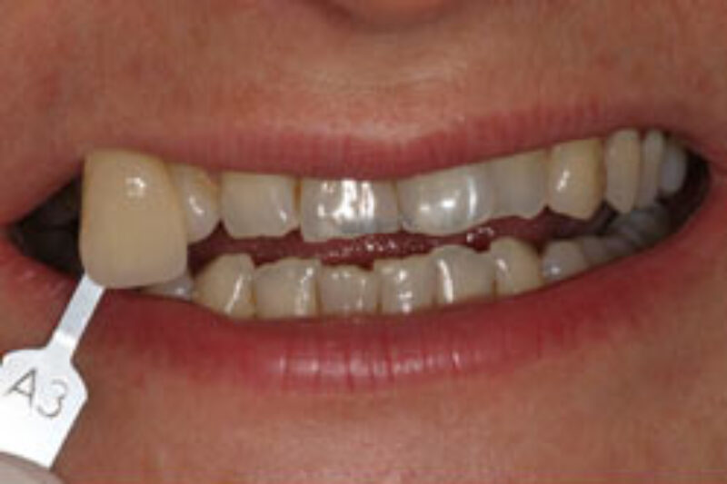 Before - Cheadle Hulme Dental