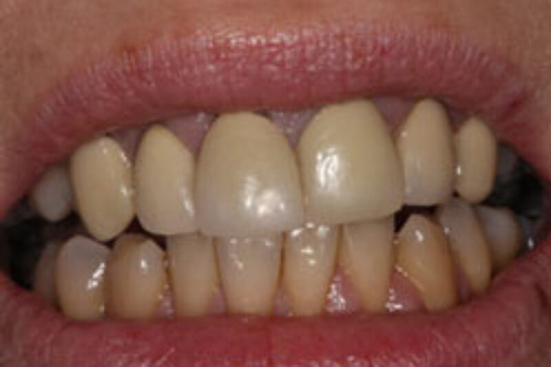 Before - Cheadle Hulme Dental