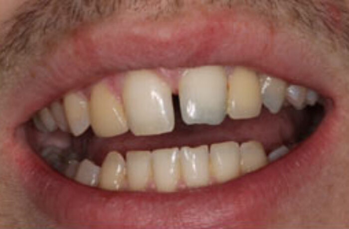 Before - Cheadle Hulme Dental