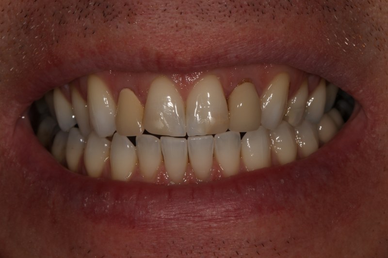 Before - Cheadle Hulme Dental