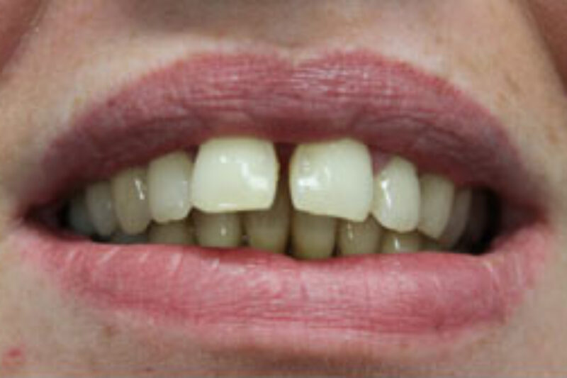 Before - Cheadle Hulme Dental