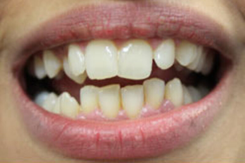 Before - Cheadle Hulme Dental