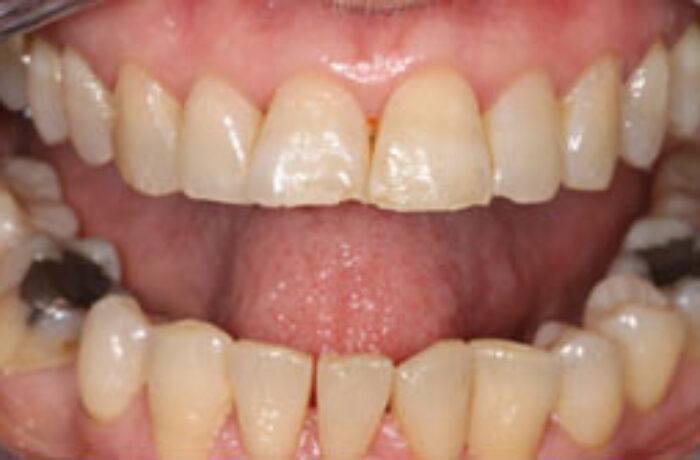 Before - Cheadle Hulme Dental