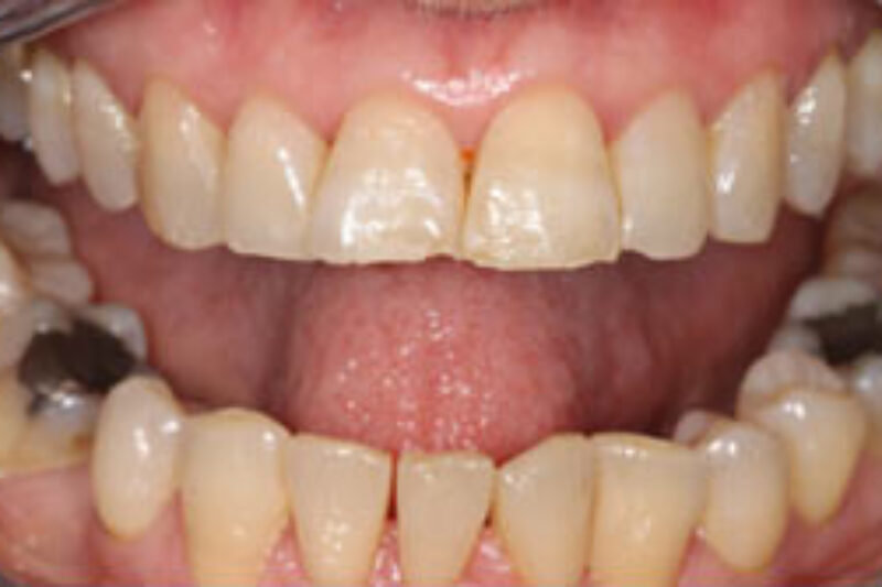 Before - Cheadle Hulme Dental