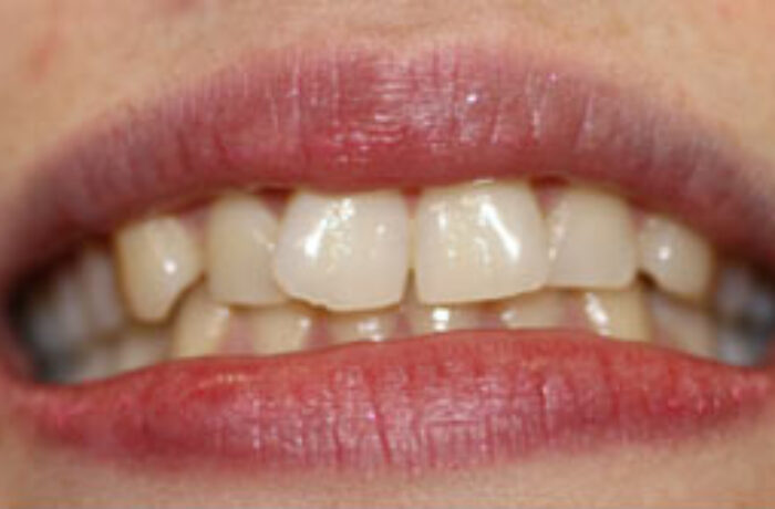 Before - Cheadle Hulme Dental