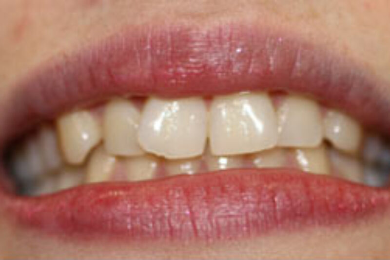 Before - Cheadle Hulme Dental