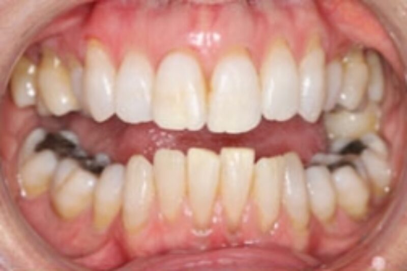 Before - Cheadle Hulme Dental