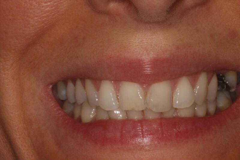 Before - Cheadle Hulme Dental