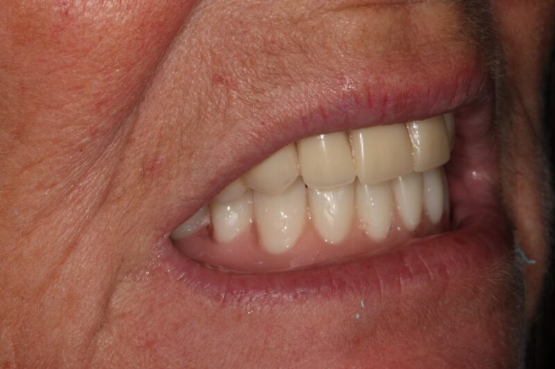 Before - Cheadle Hulme Dental